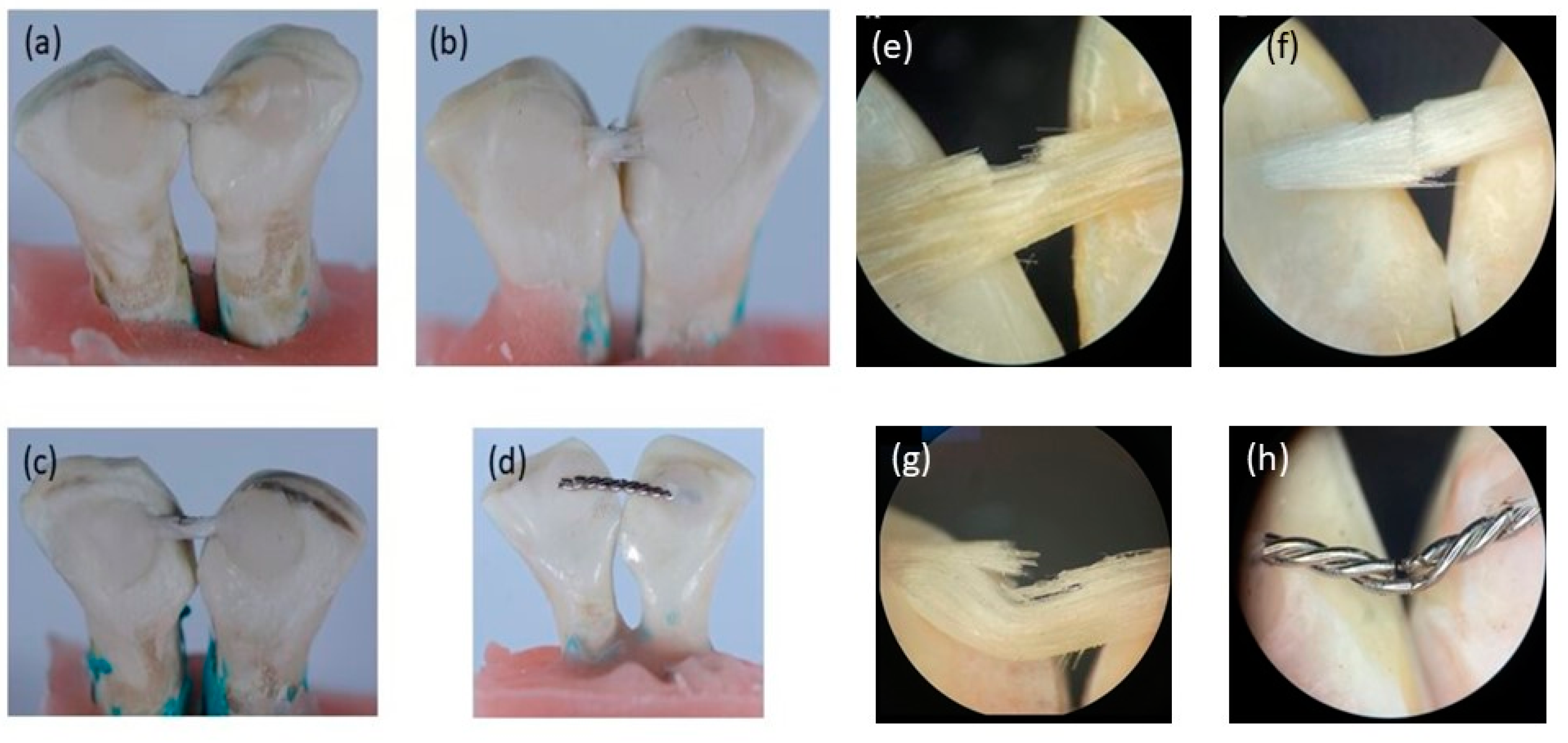 Materials 15 03504 g004 Materials 15 03504 g004