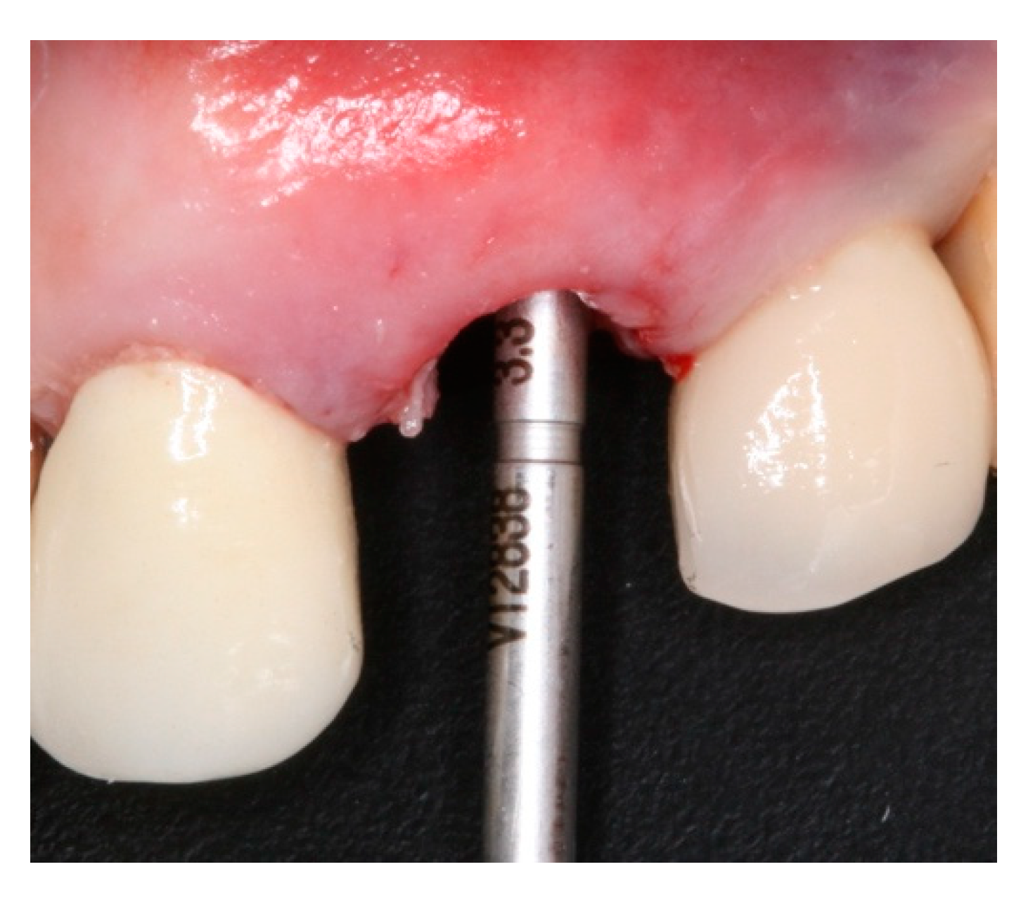 Materials 15 03539 g005