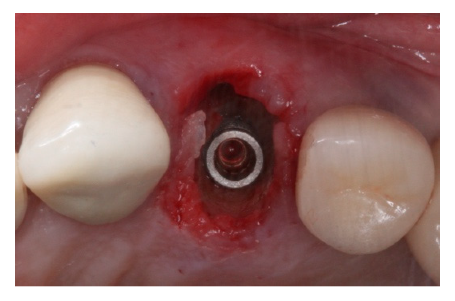 Materials 15 03539 g006