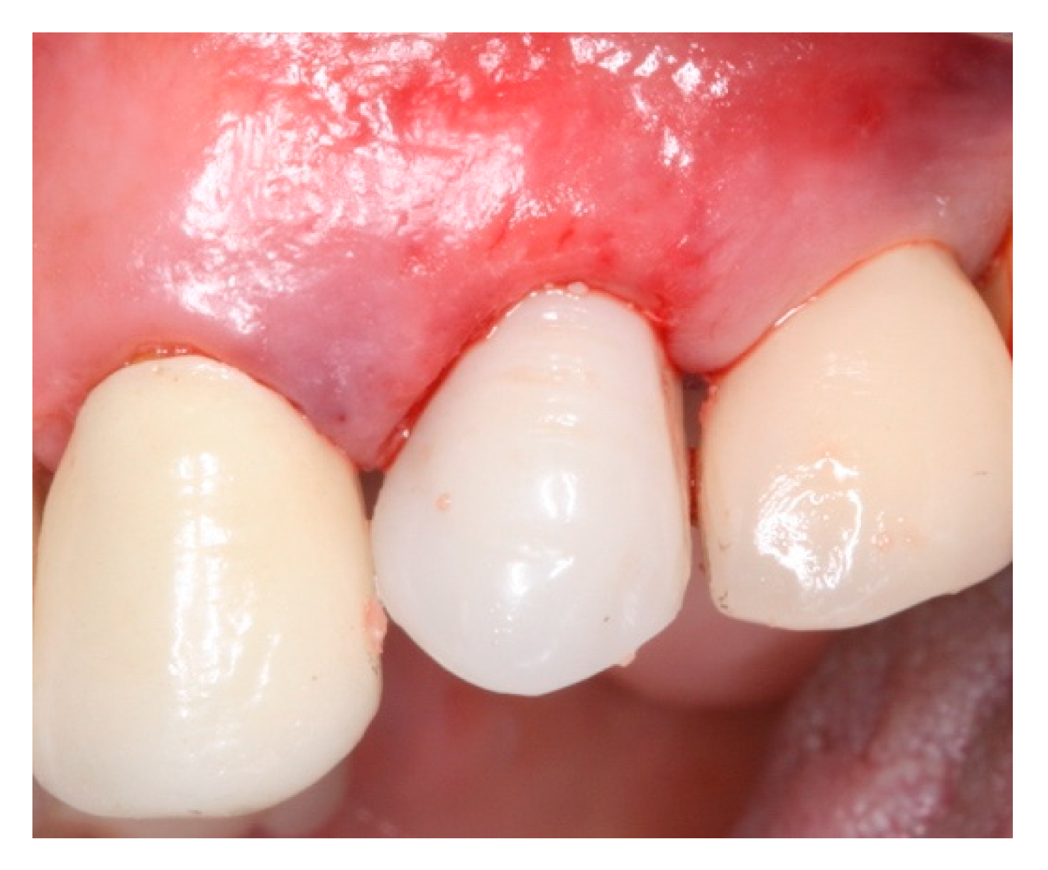 Materials 15 03539 g008