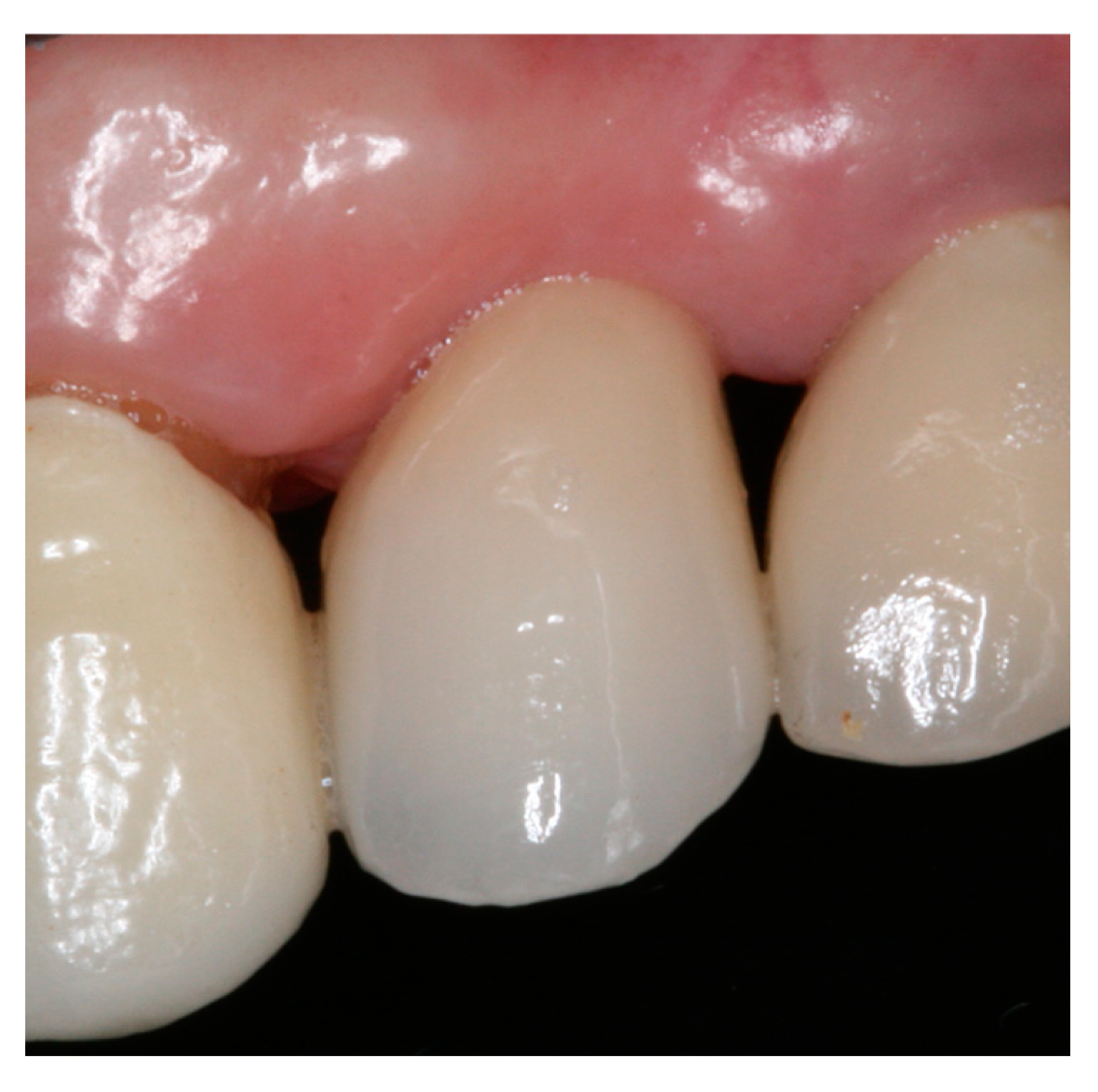 Materials 15 03539 g009