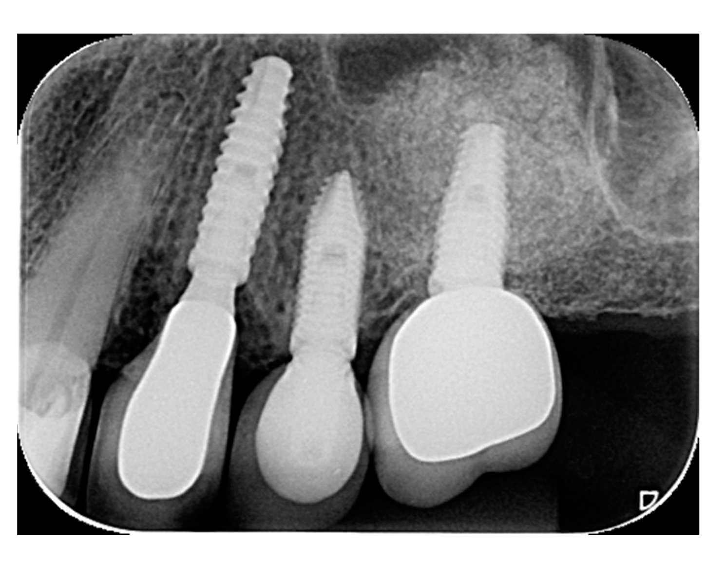 Materials 15 03539 g010