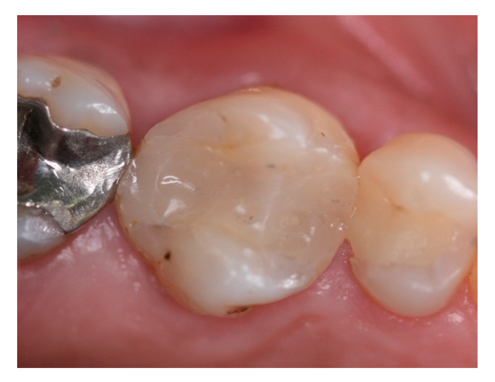 Materials 15 03539 g011