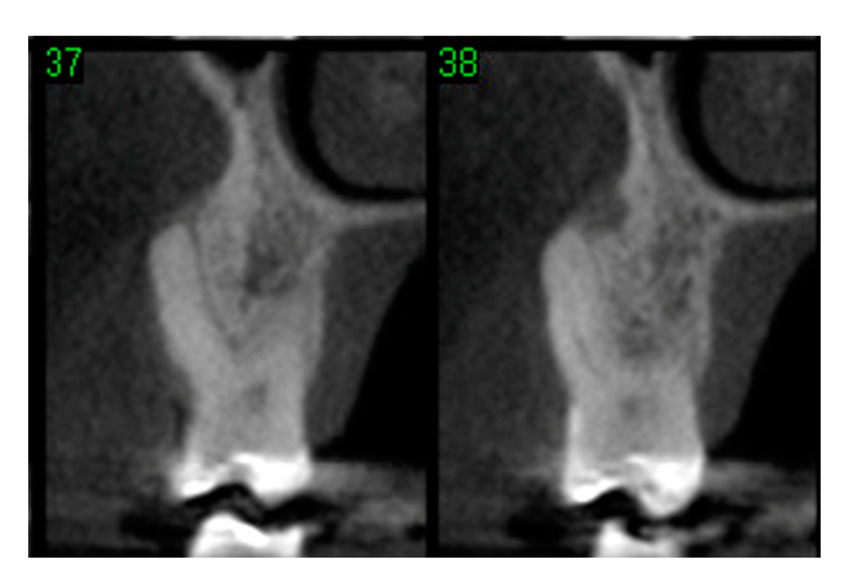 Materials 15 03539 g012