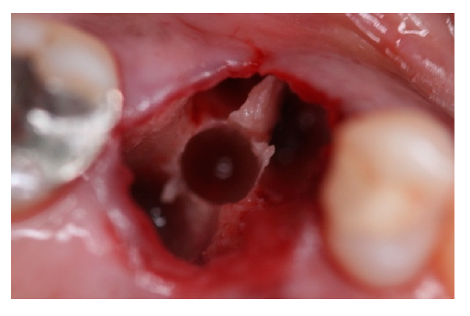 Materials 15 03539 g013