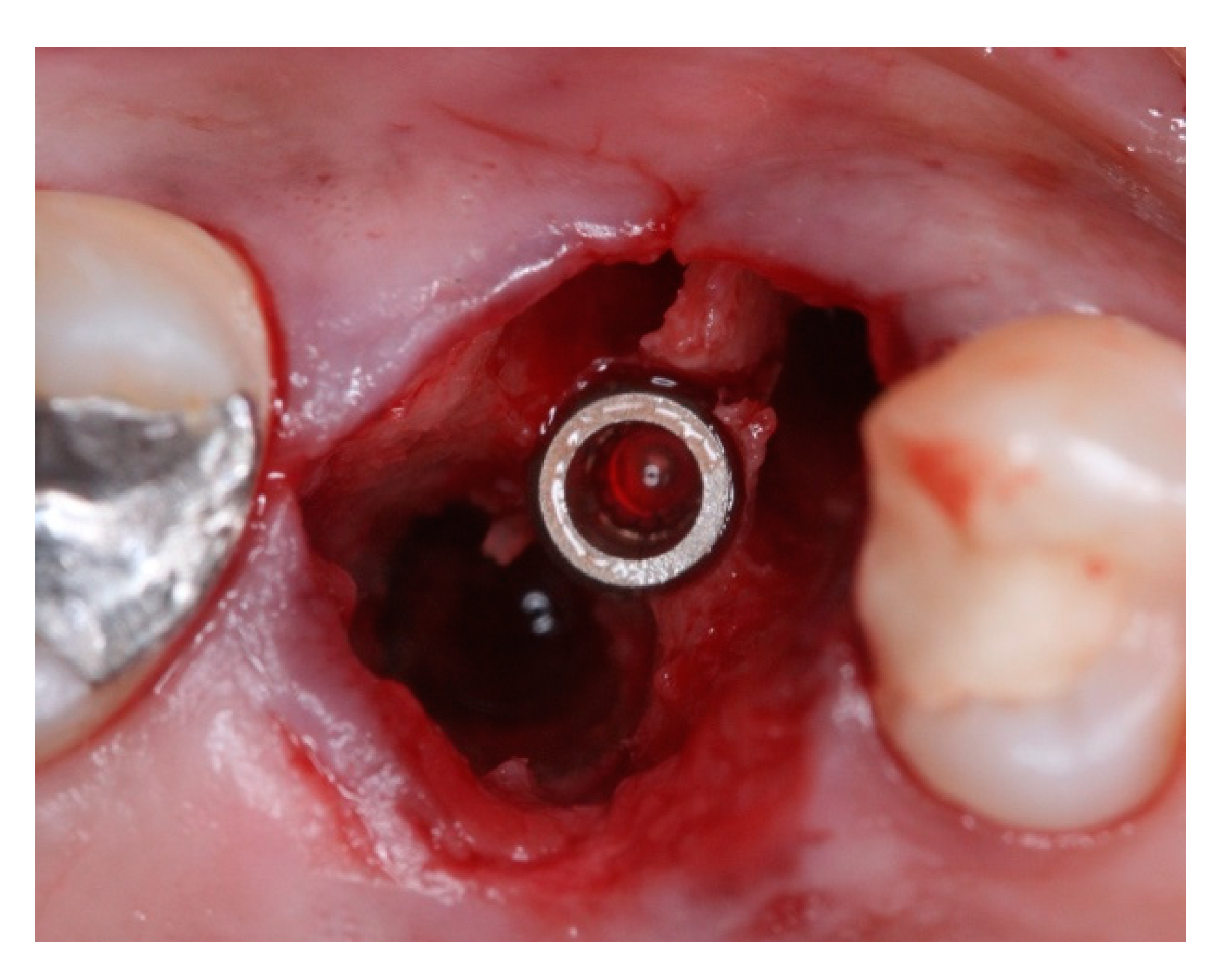 Materials 15 03539 g014