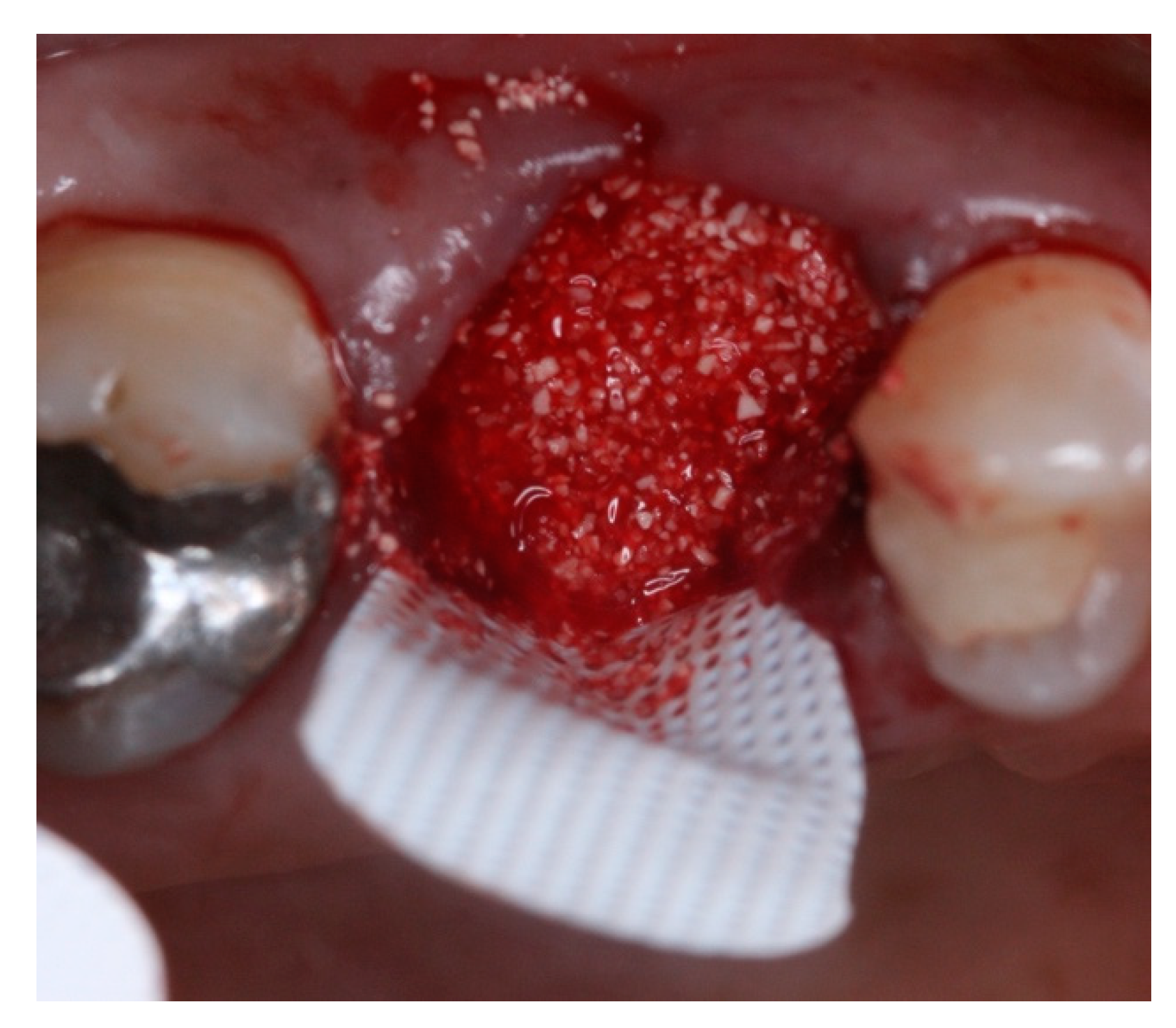 Materials 15 03539 g015