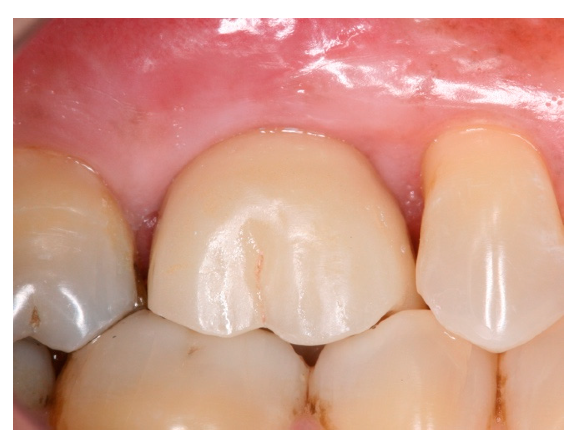 Materials 15 03539 g017