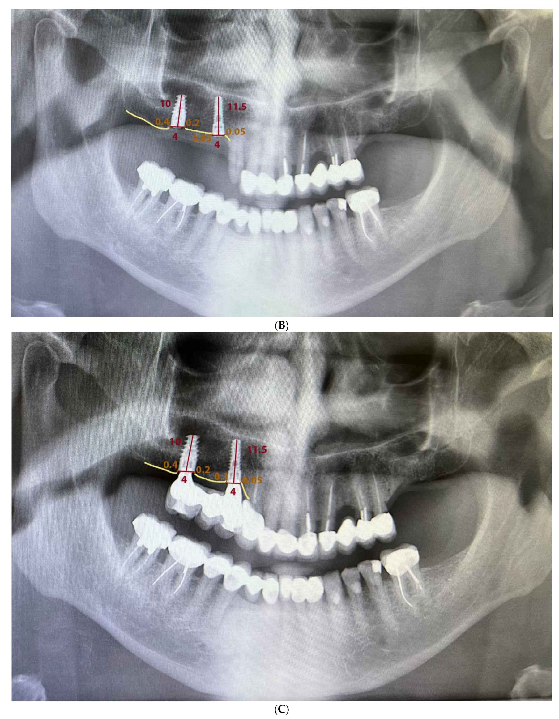 Materials 15 03729 g002b 550