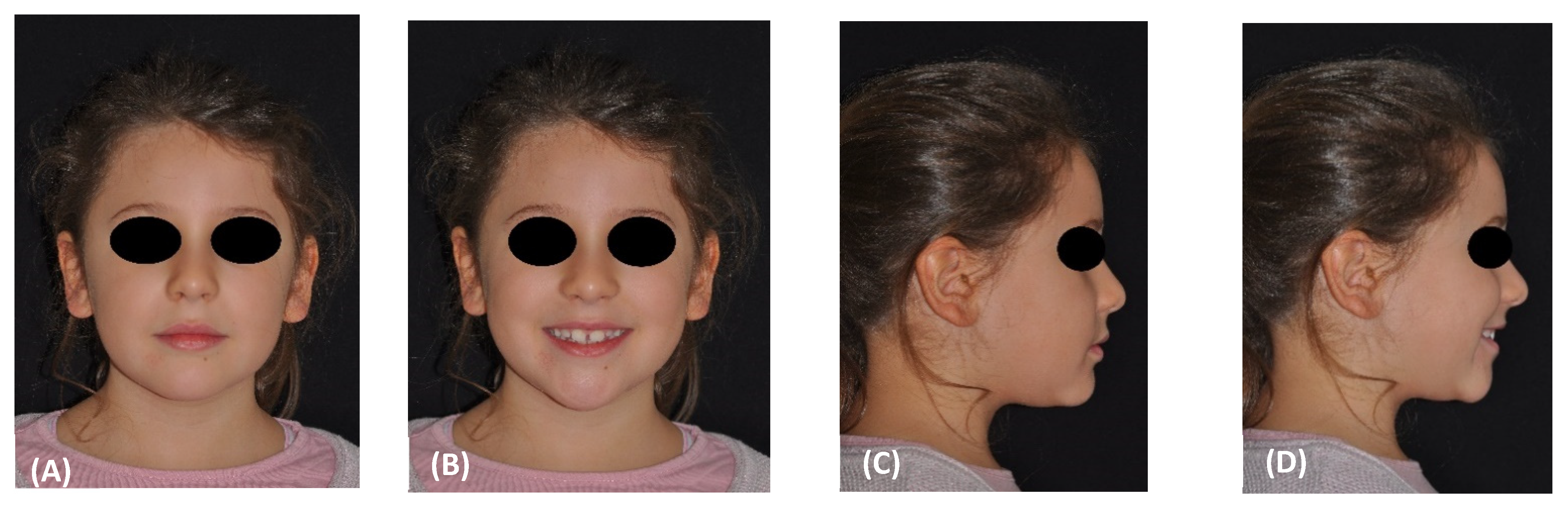 Materials 15 03747 g001a