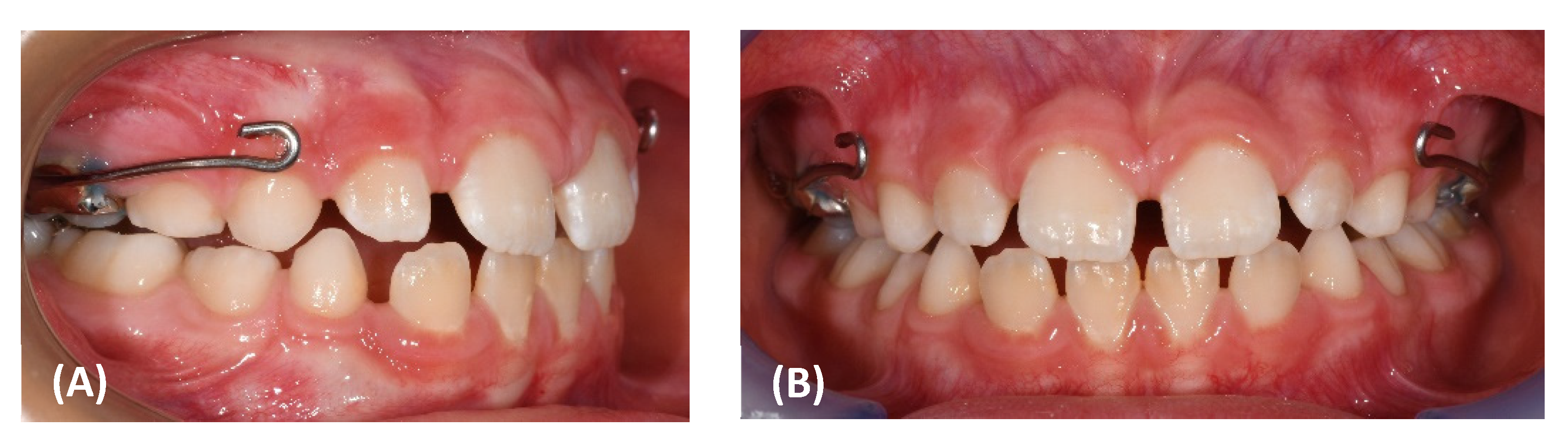 Materials 15 03747 g004a