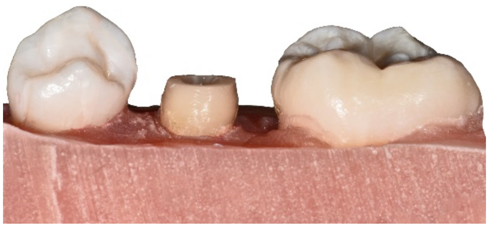 Materials 15 04199 g002 550