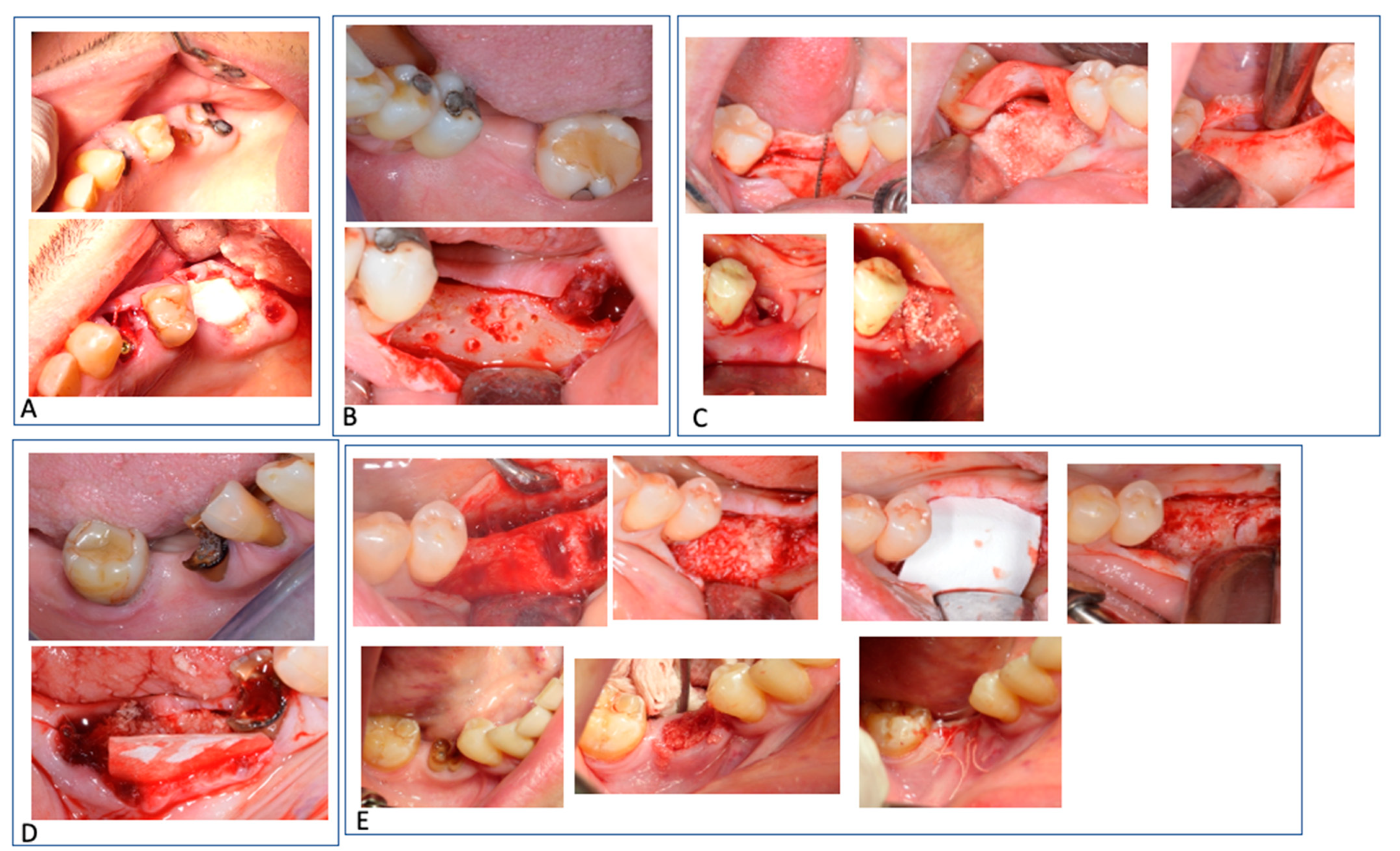 Materials 15 04319 g005