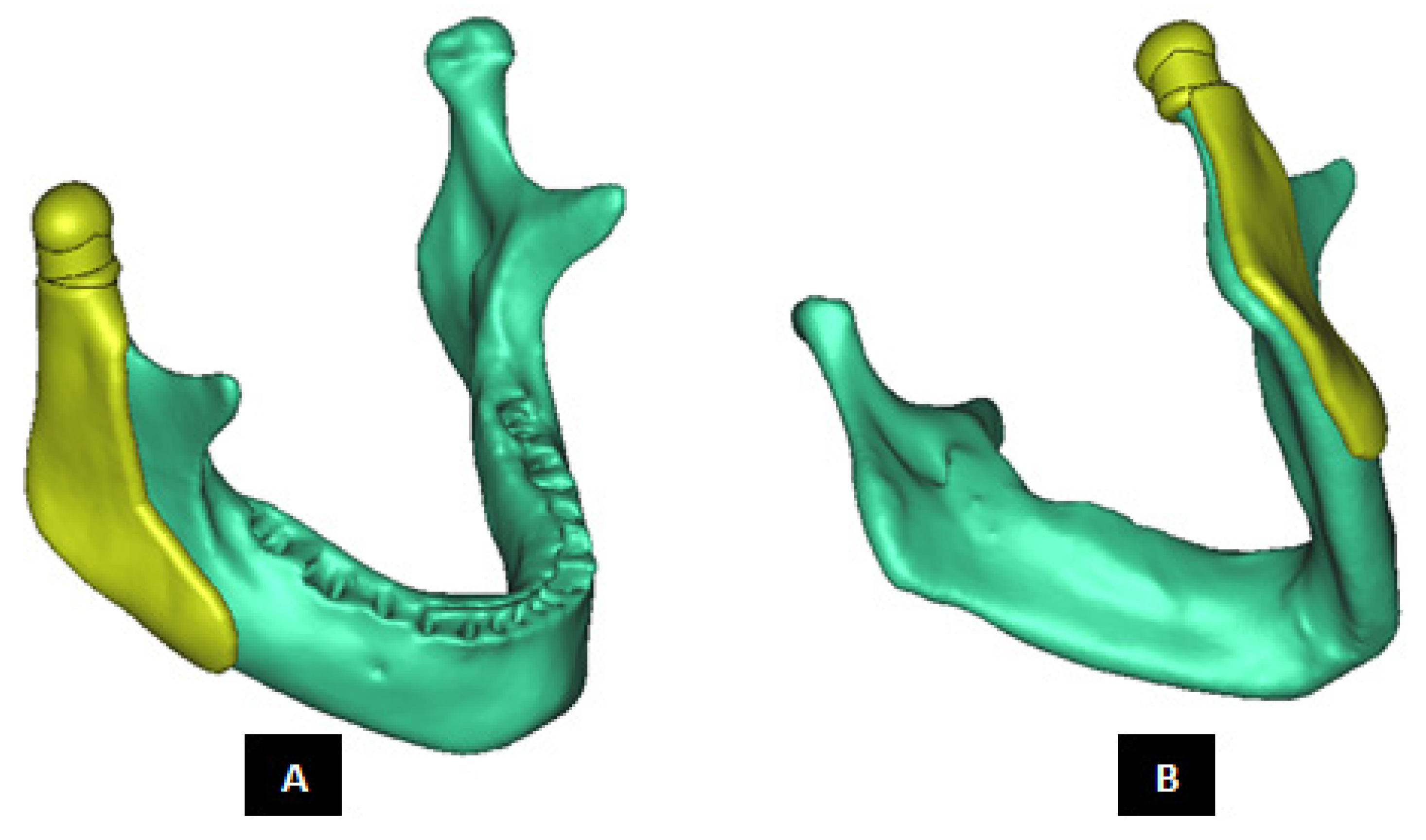 Materials 15 04342 g005 550
