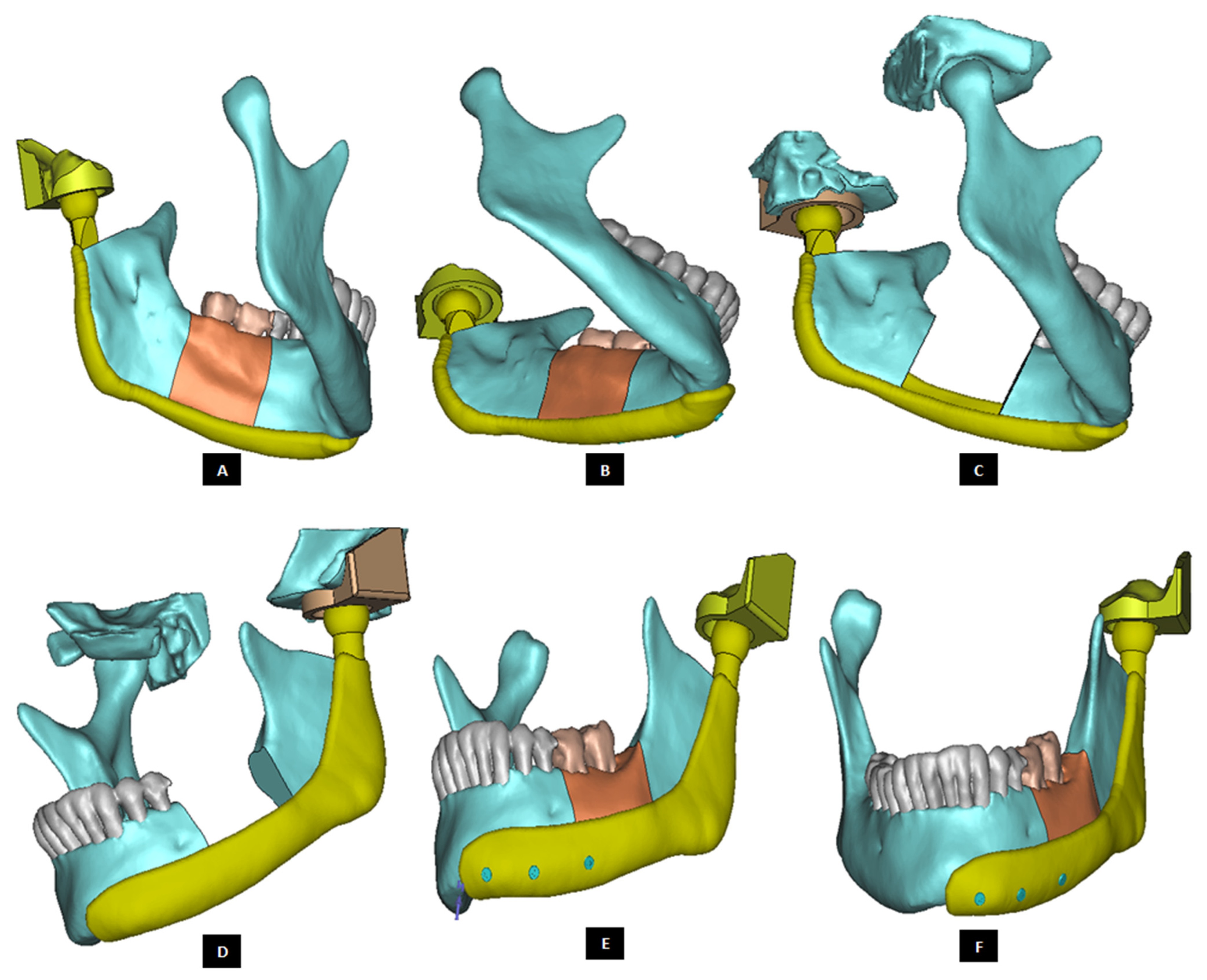 Materials 15 04342 g020 550