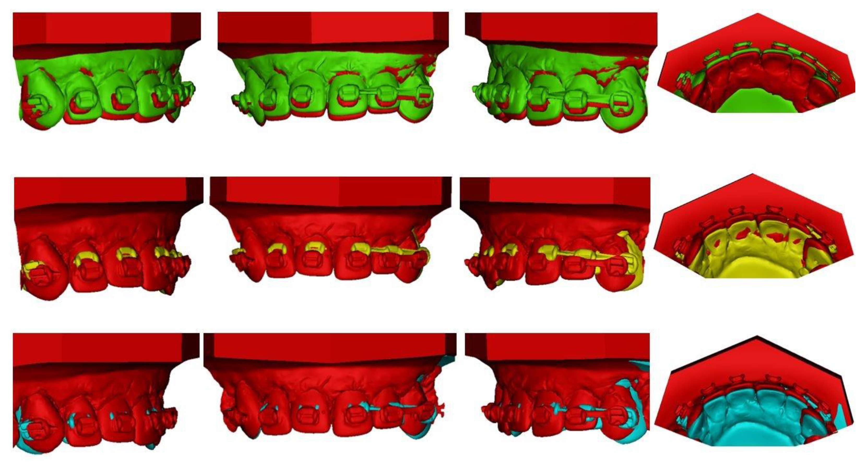 Materials 15 04815 g016