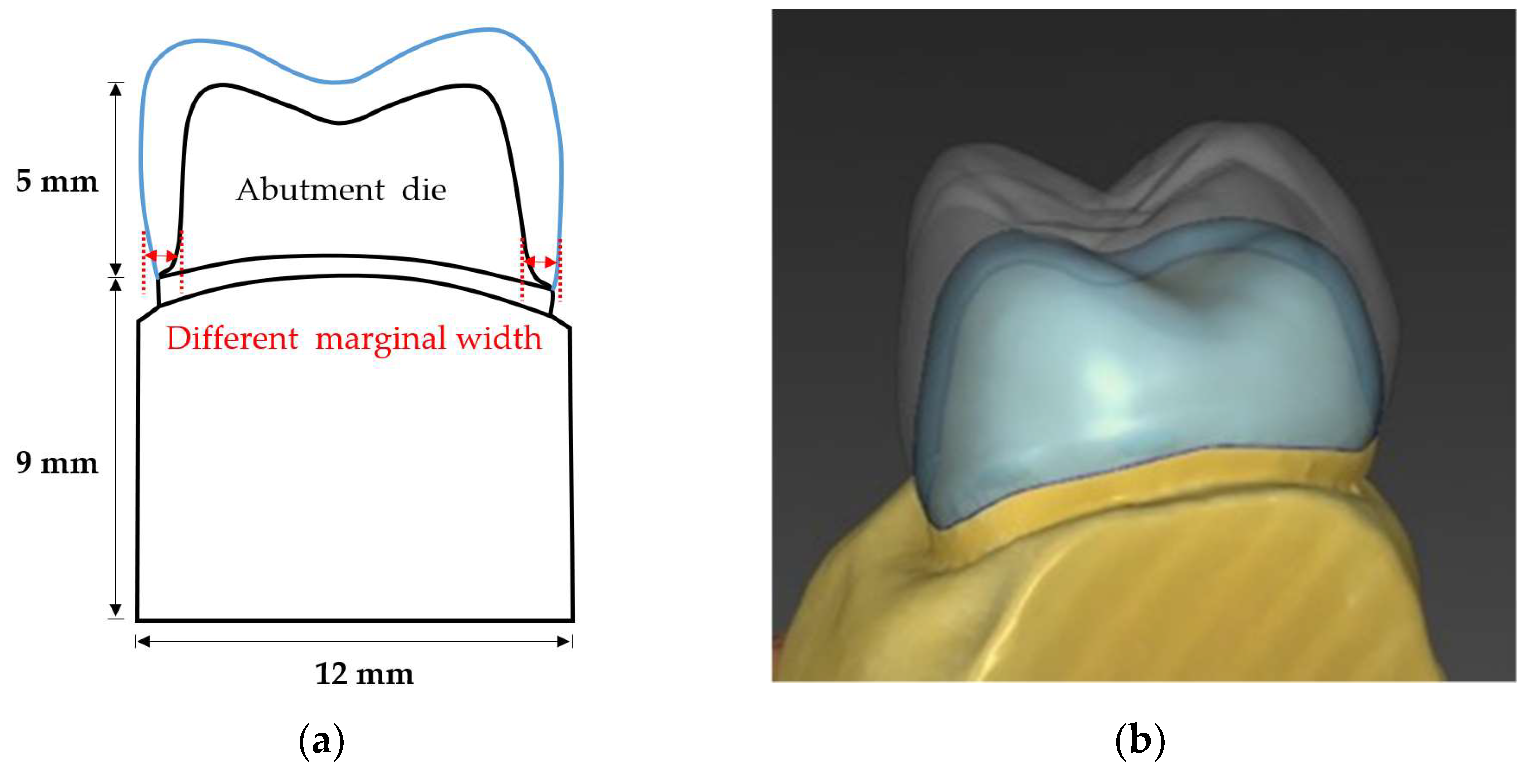 Materials Free FullText Fracture Resistance of Monolithic Zirconia