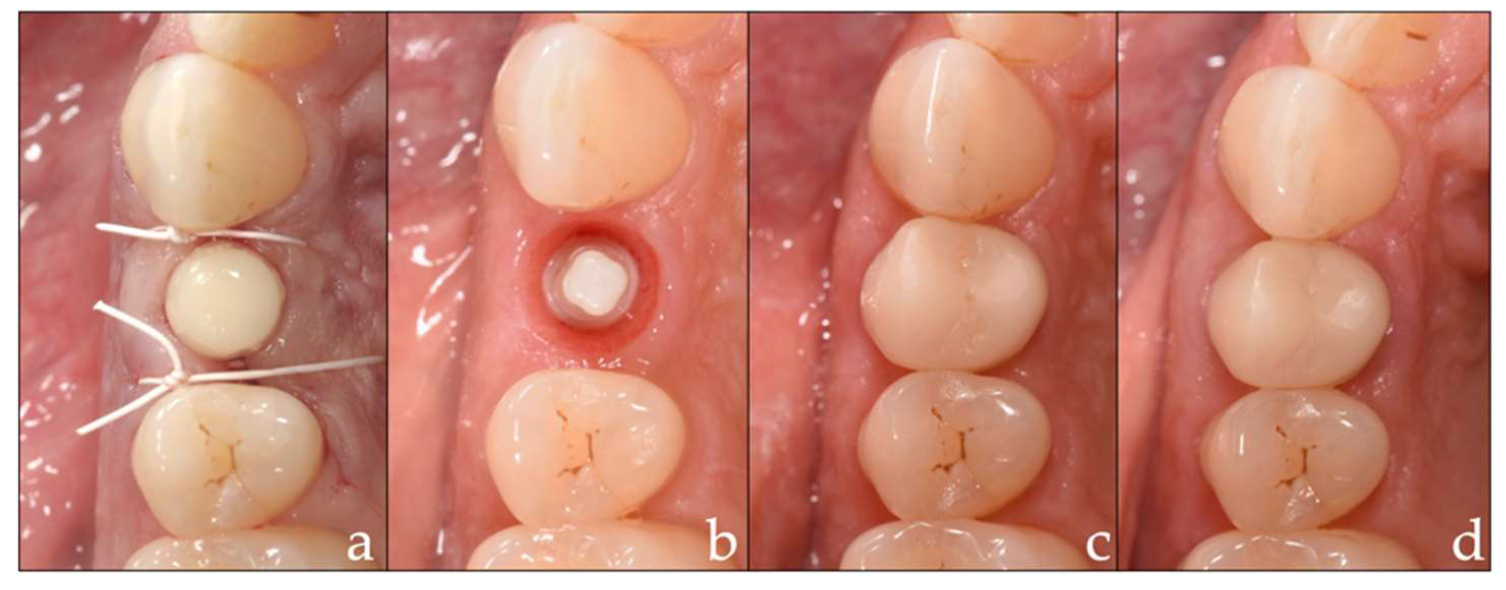 Materials 15 05584 g002