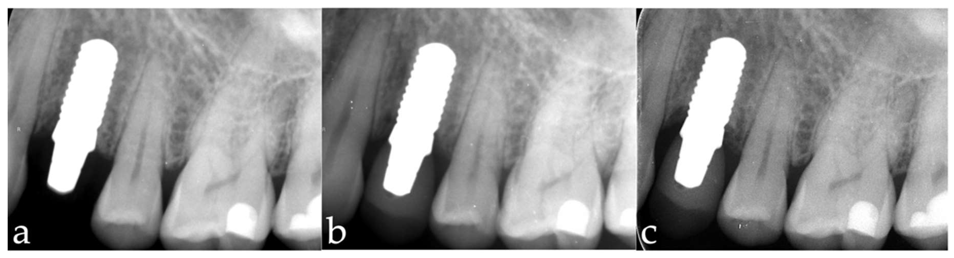 Materials 15 05584 g003