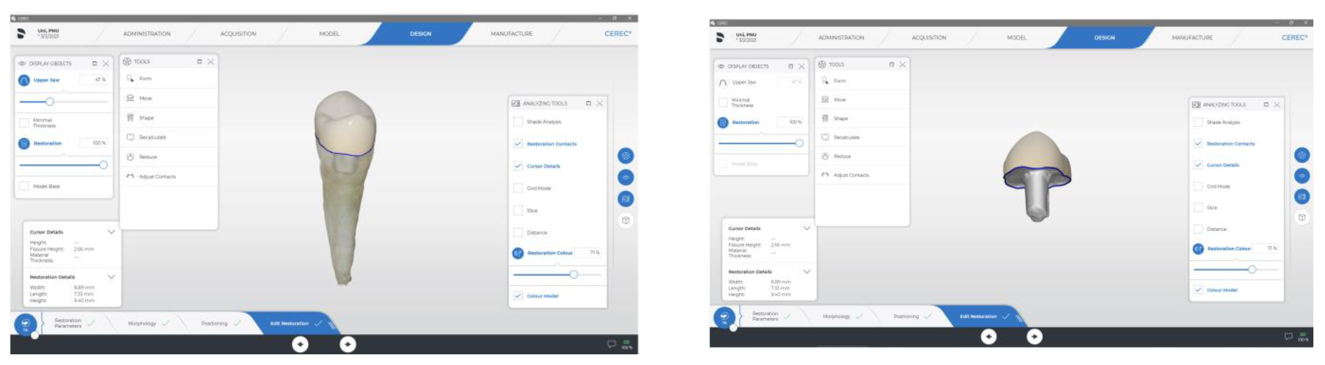 Materials 15 05592 g004