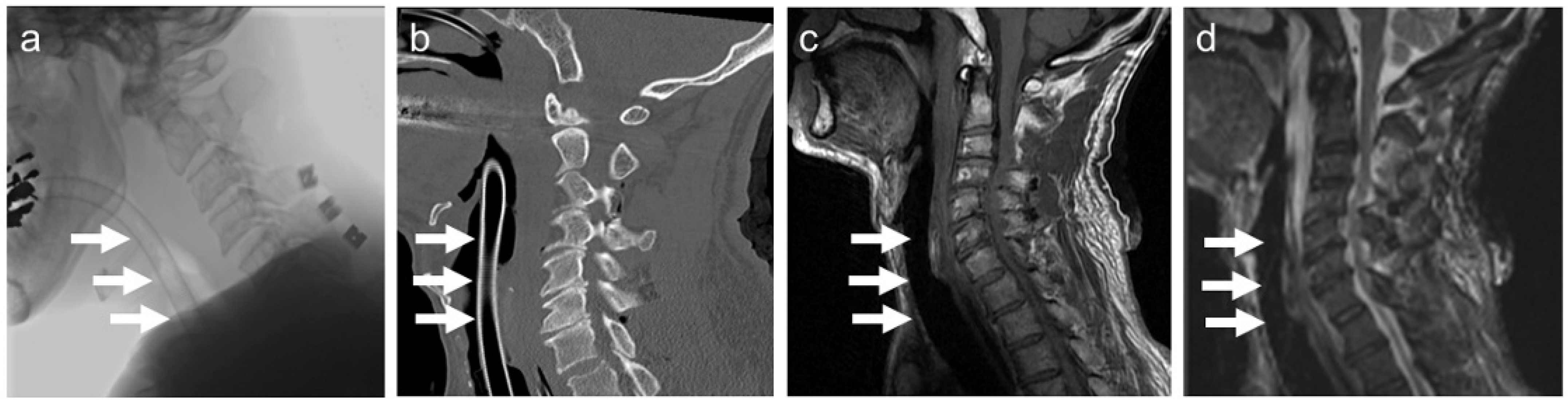 Materials 15 05632 g005 550