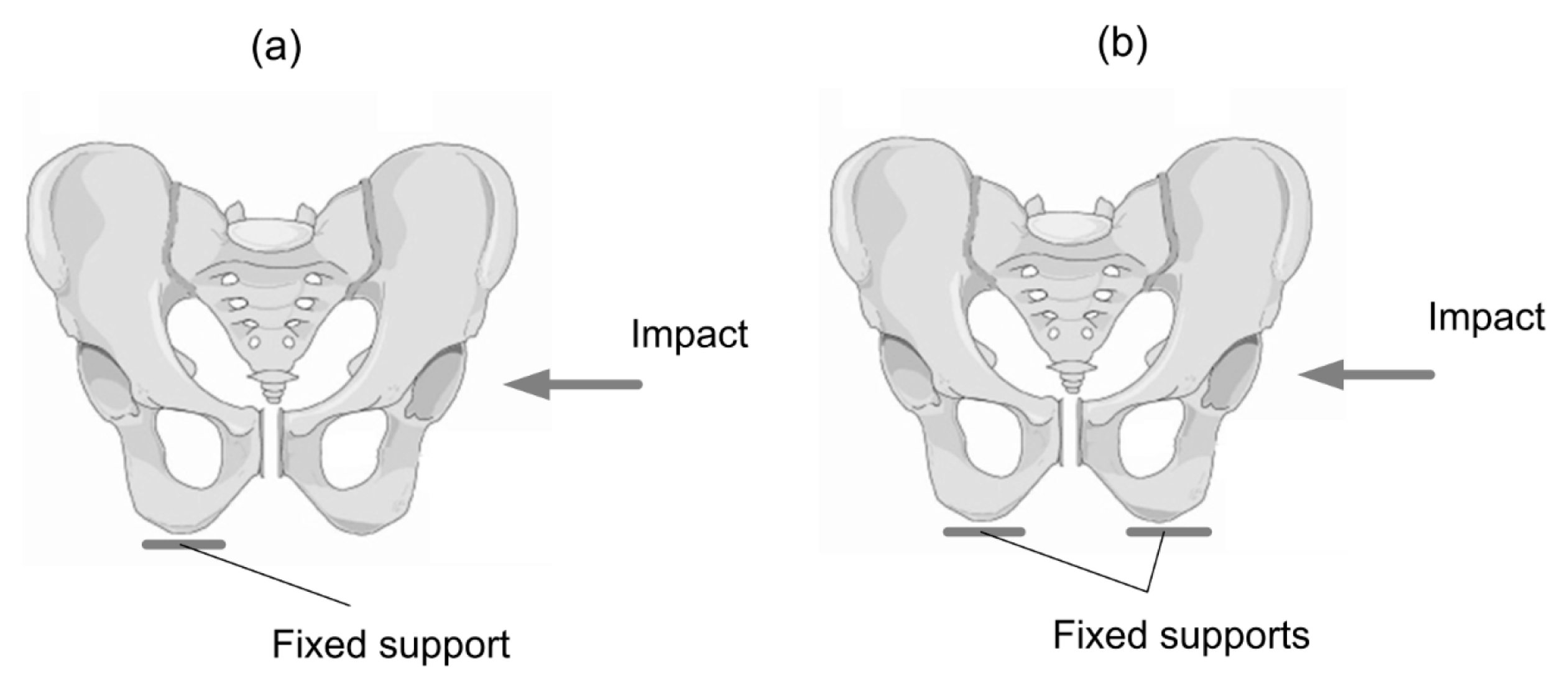 Materials 15 05734 g004