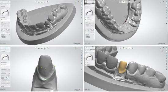 Materials | Free Full-Text | The Impact of Sintering Technology and ...