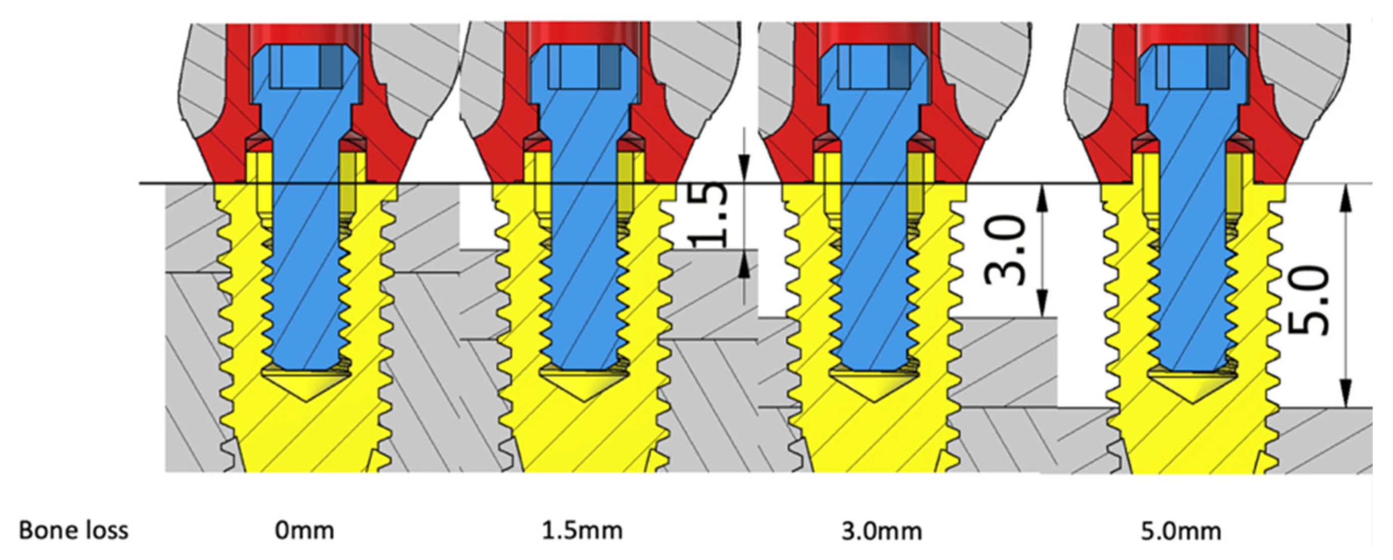 Materials 15 05866 g002 Materials 15 05866 g002