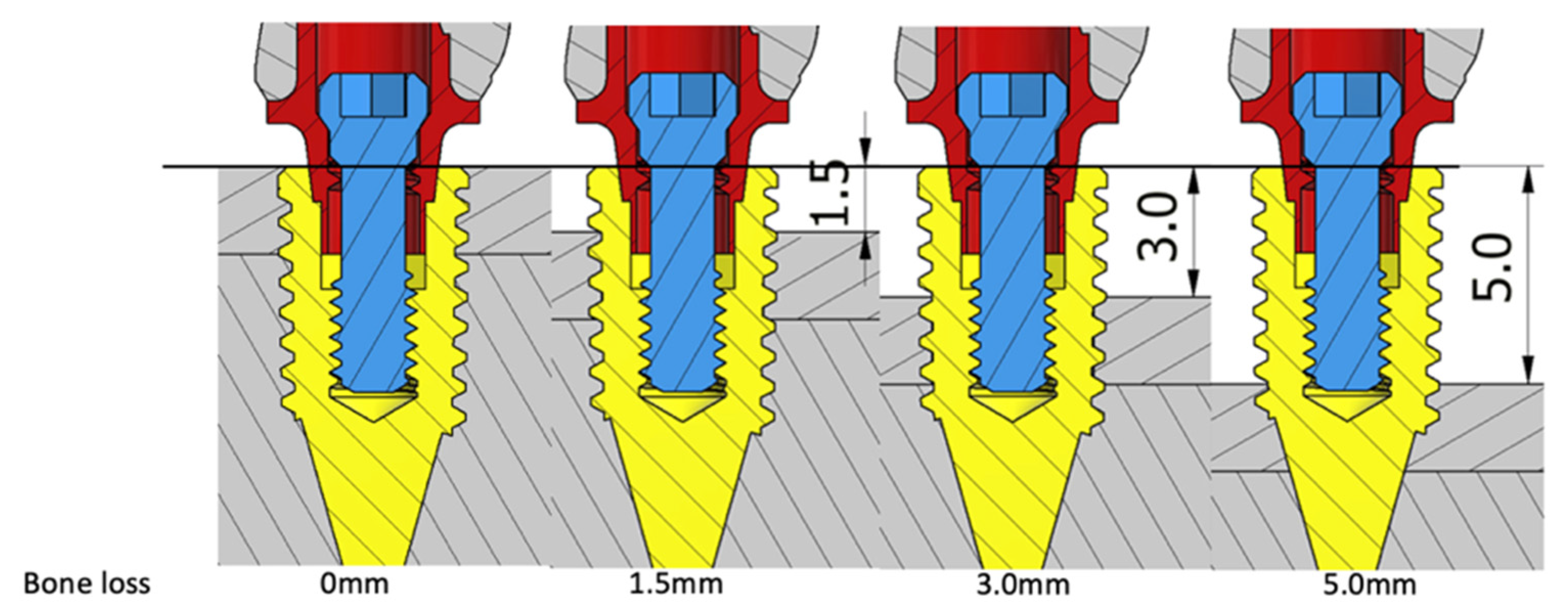 Materials 15 05866 g003 Materials 15 05866 g003