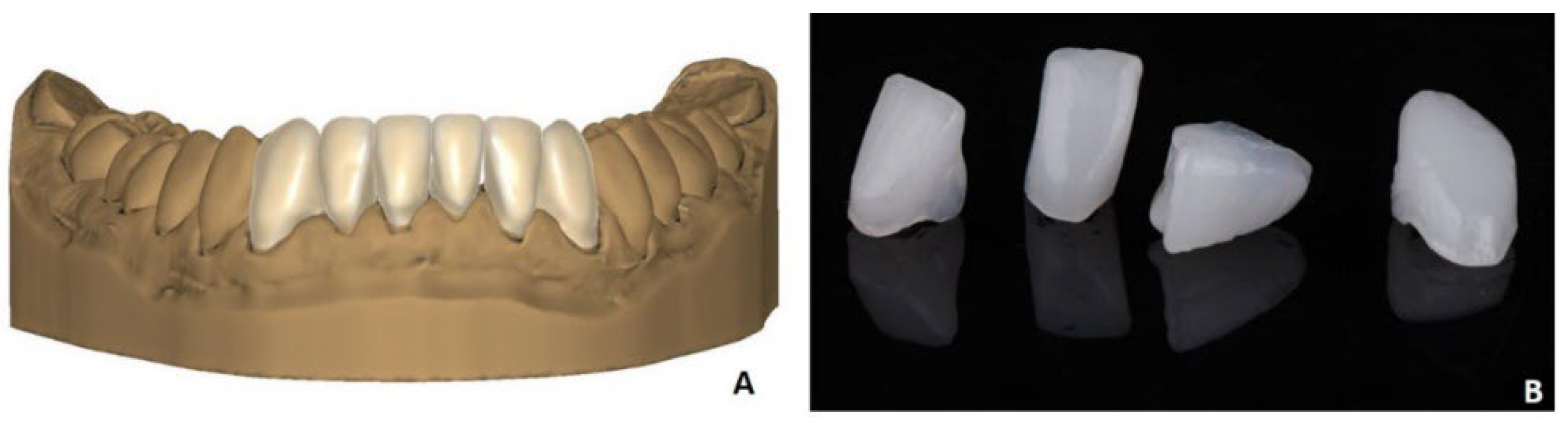 Materials 15 06034 g002 550