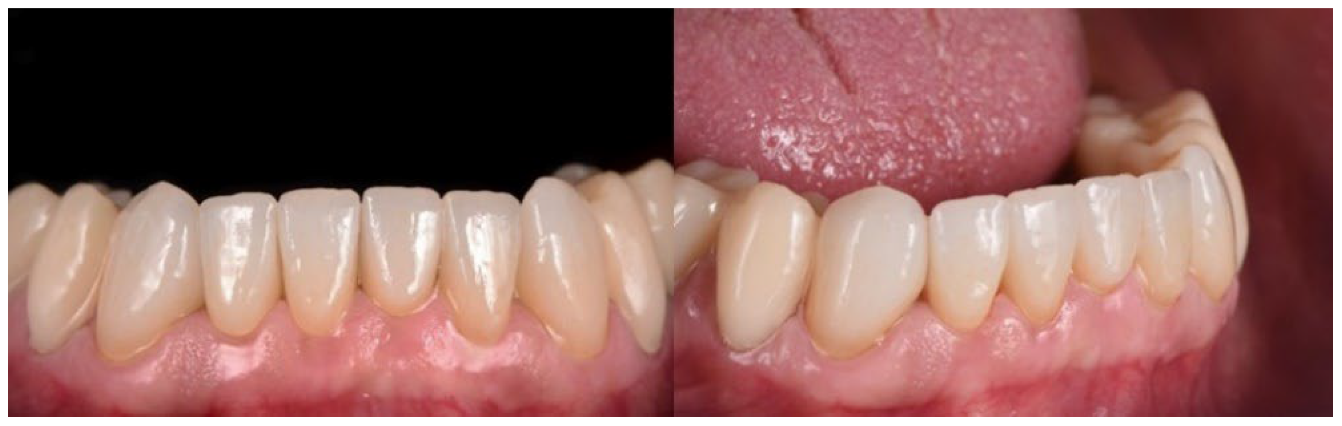 Materials 15 06034 g003 550