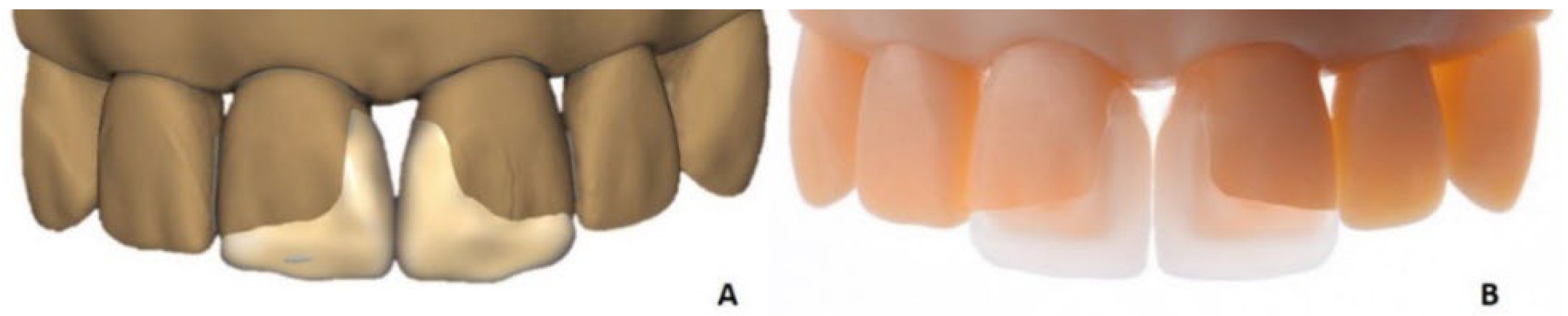 Materials 15 06034 g005 550