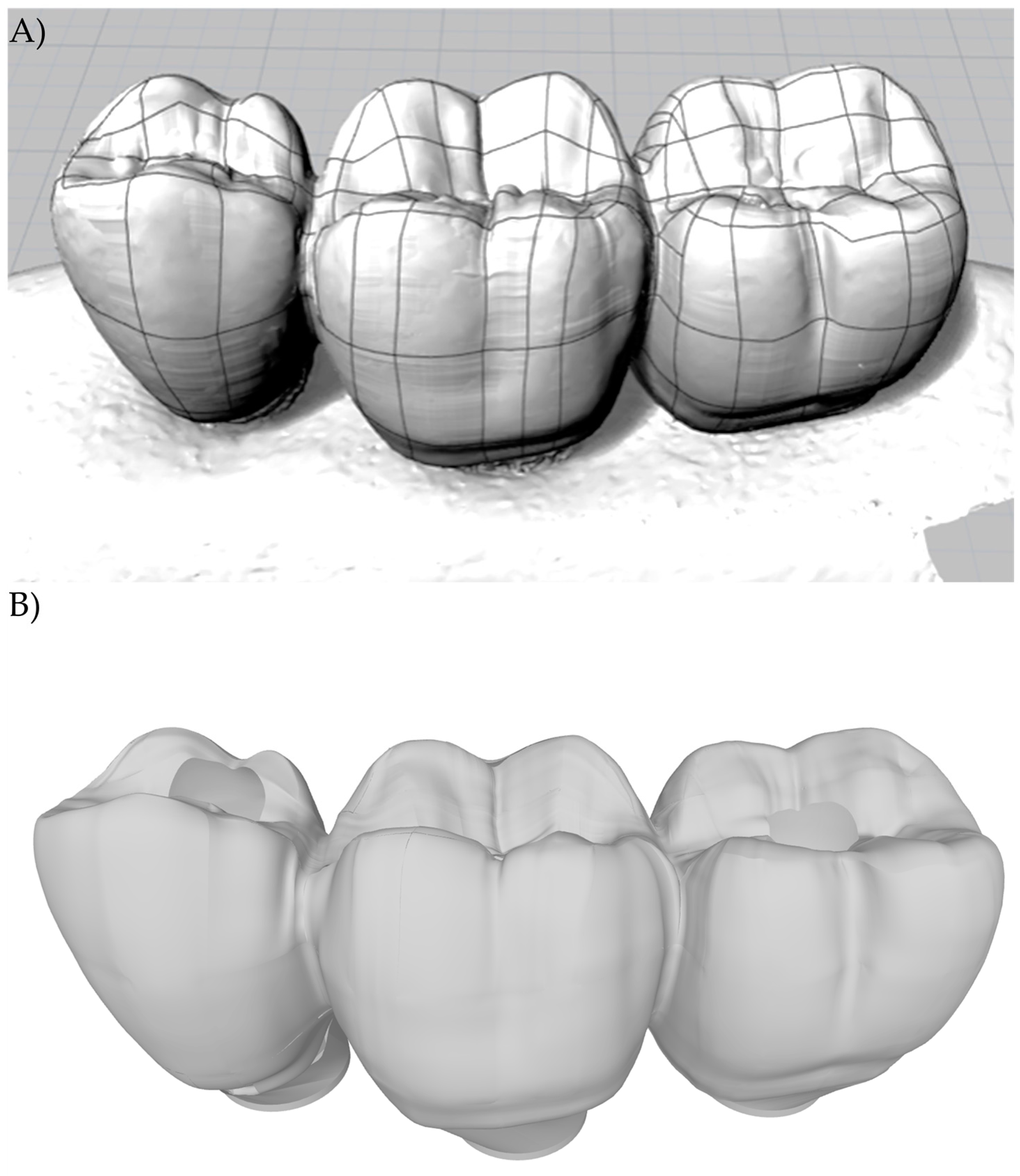 Materials Free FullText Influence of Abutment Design on