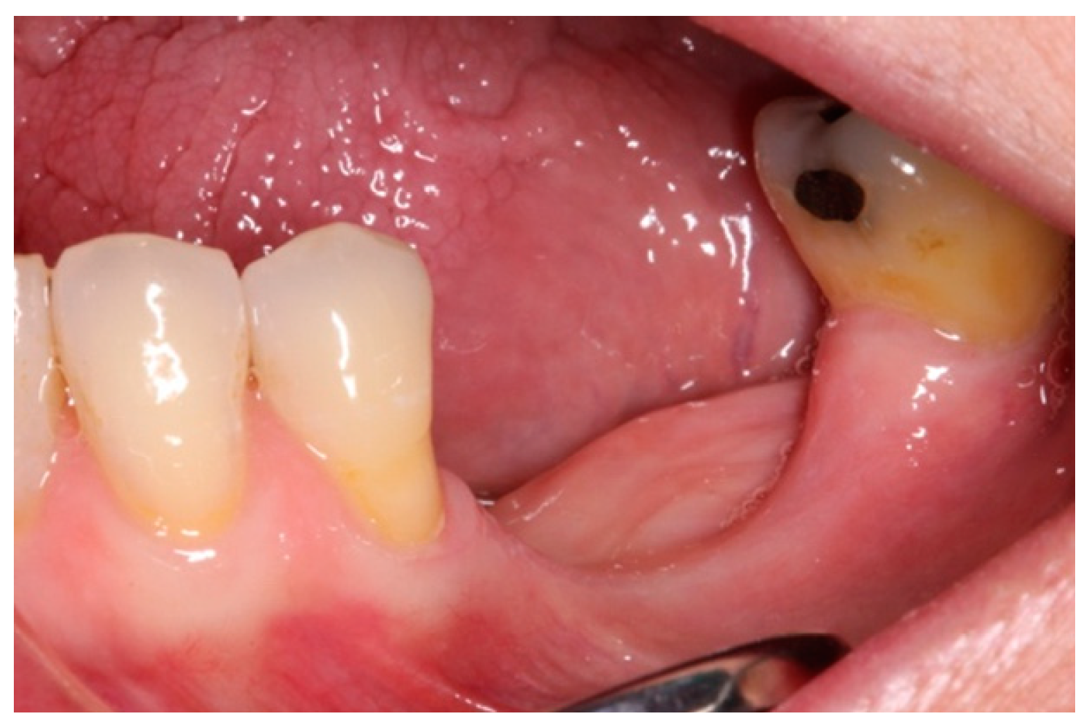 Materials 15 06271 g001 550