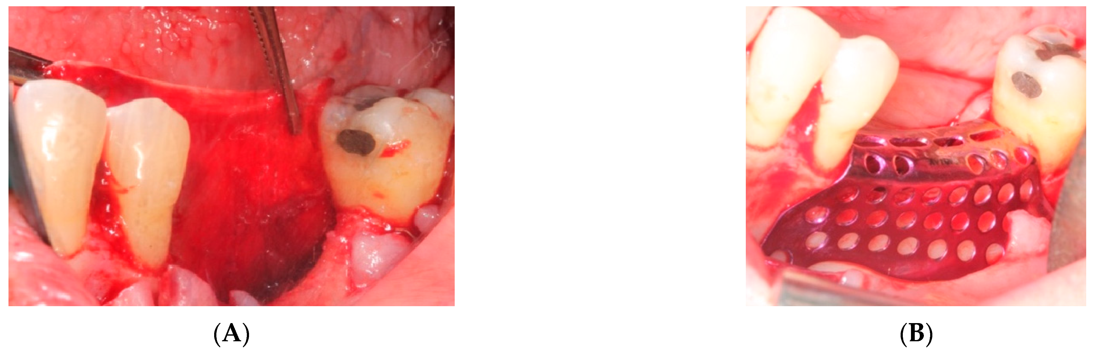 Materials 15 06271 g003 550