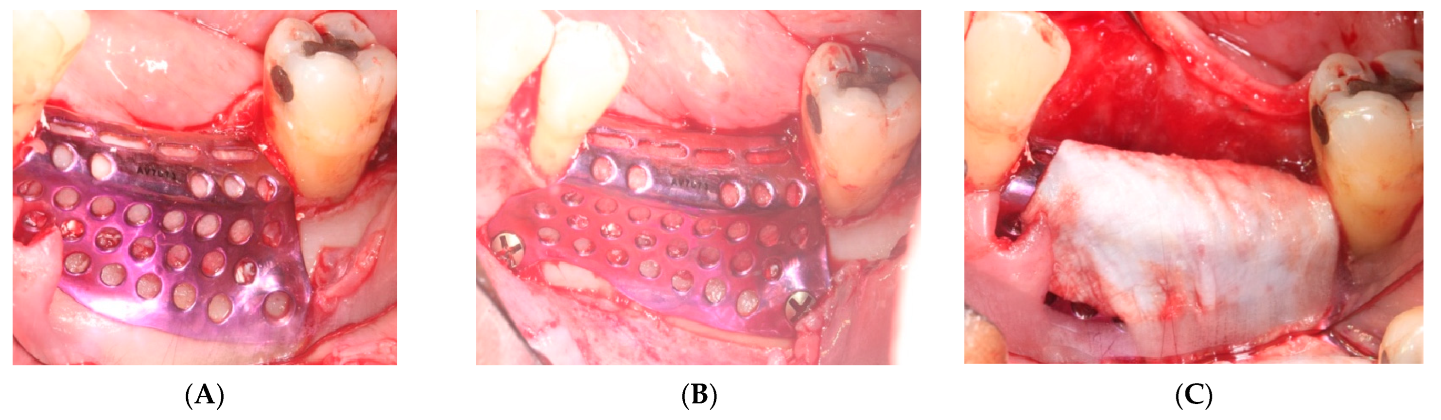 Materials 15 06271 g005 550