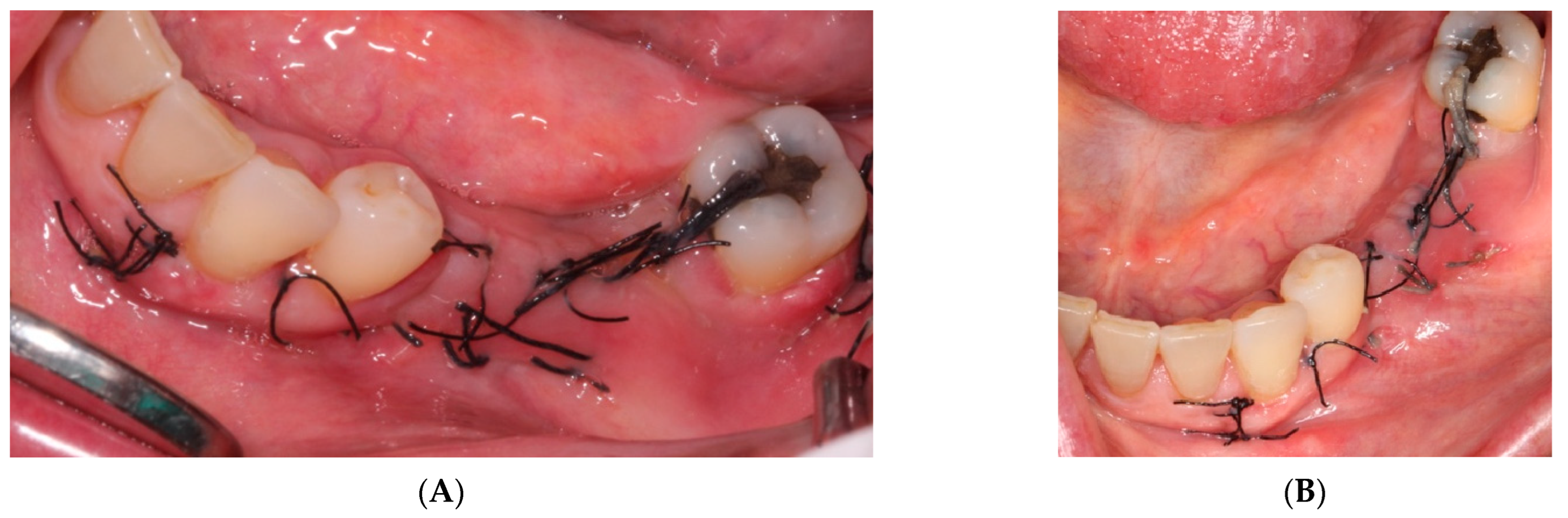 Materials 15 06271 g008 550