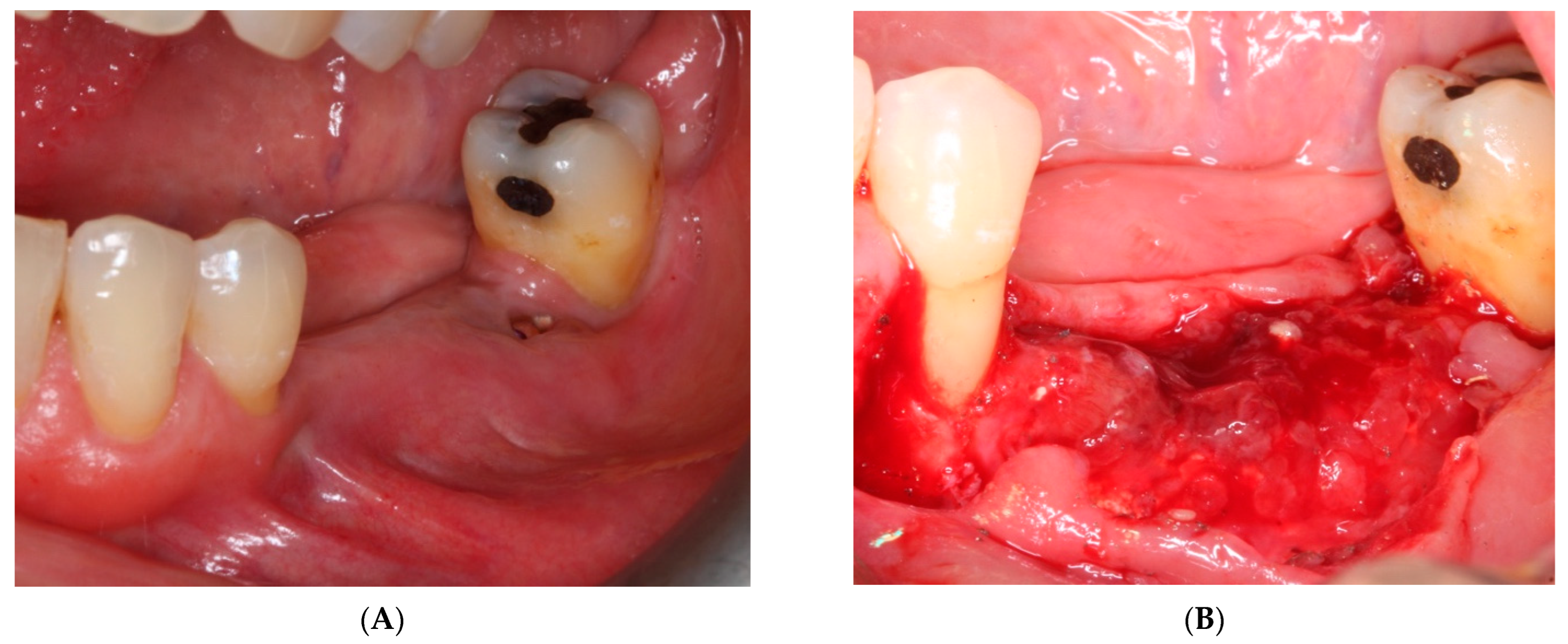 Materials 15 06271 g009 550