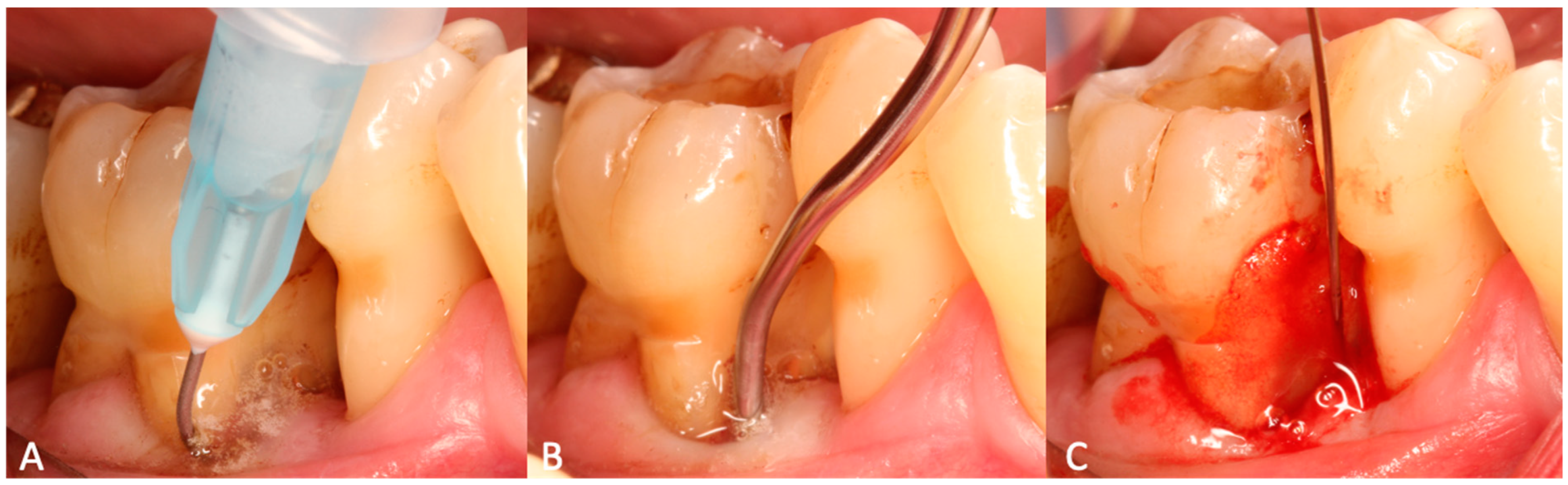 Materials 15 06508 g001 550