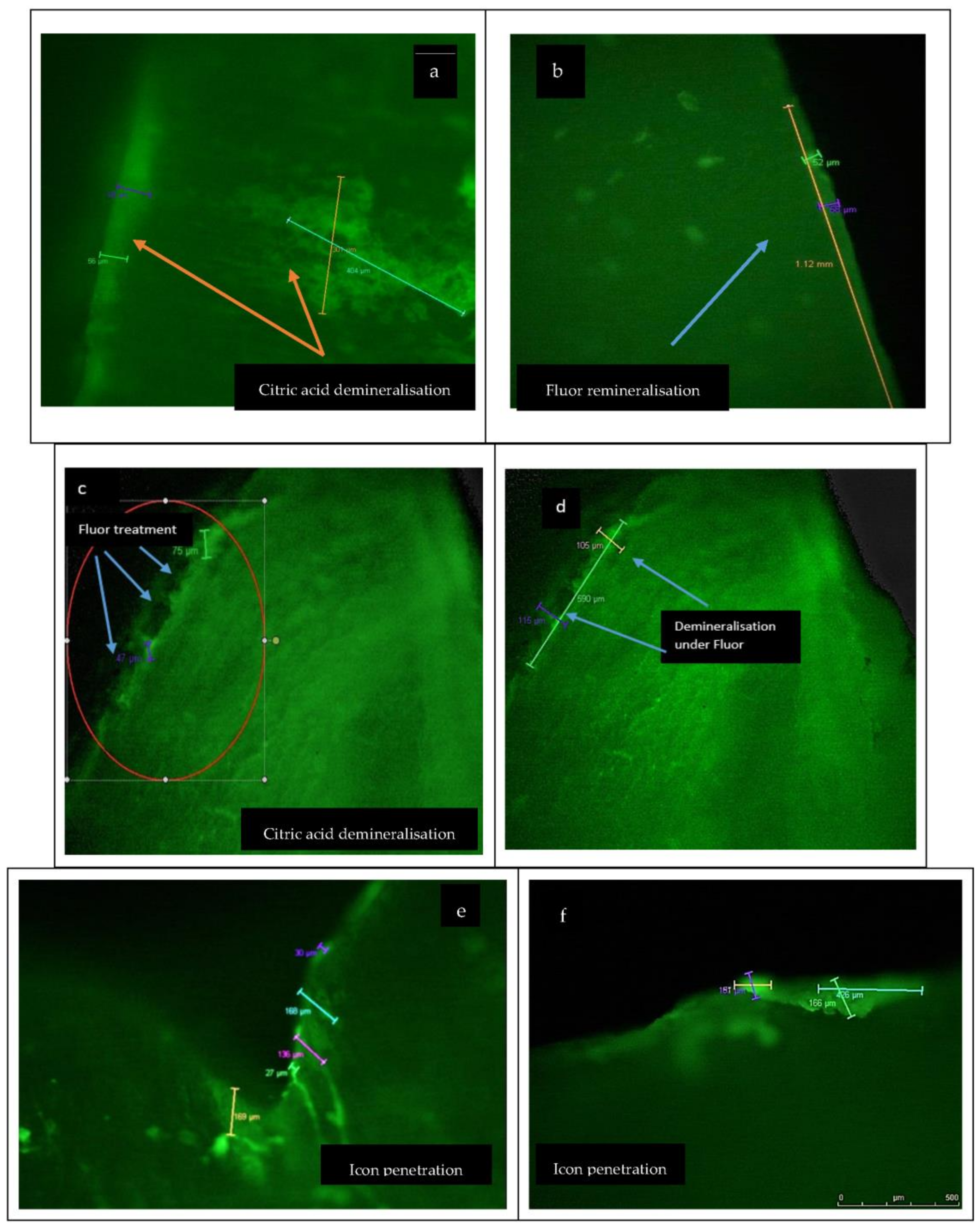 Materials 15 07258 g002a
