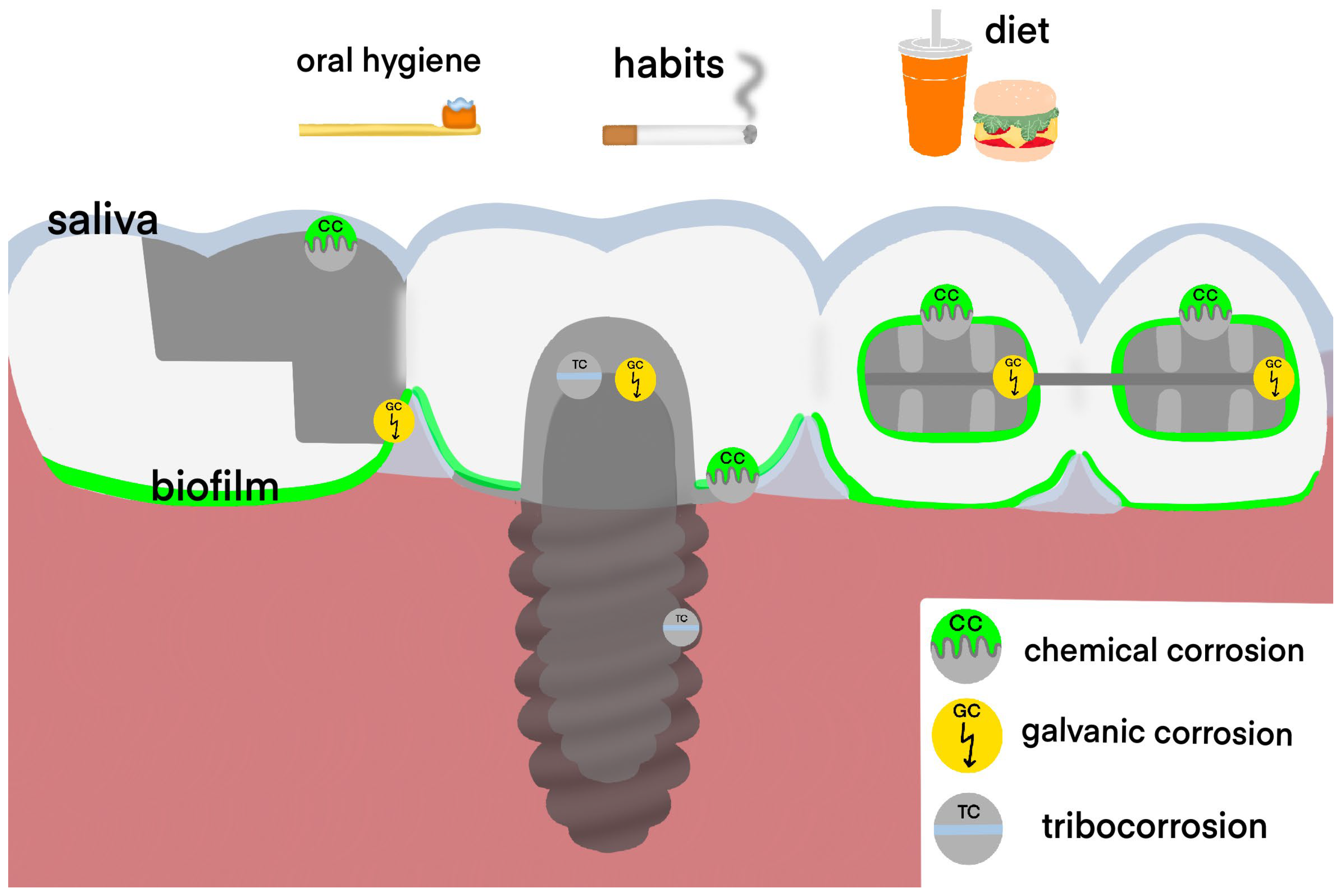Materials Free FullText Minimization of Adverse Effects Associated