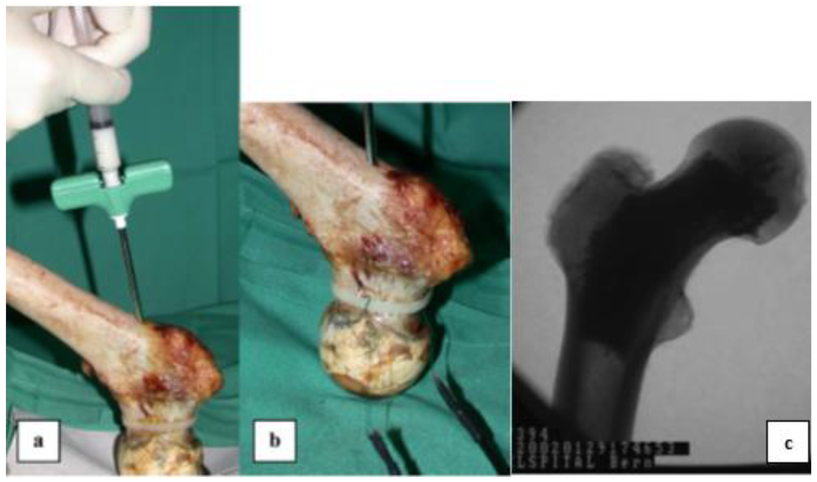 Materials 15 07477 g012