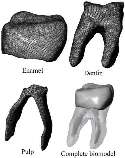 Numerical Analysis of Zirconium and Titanium Implants under
