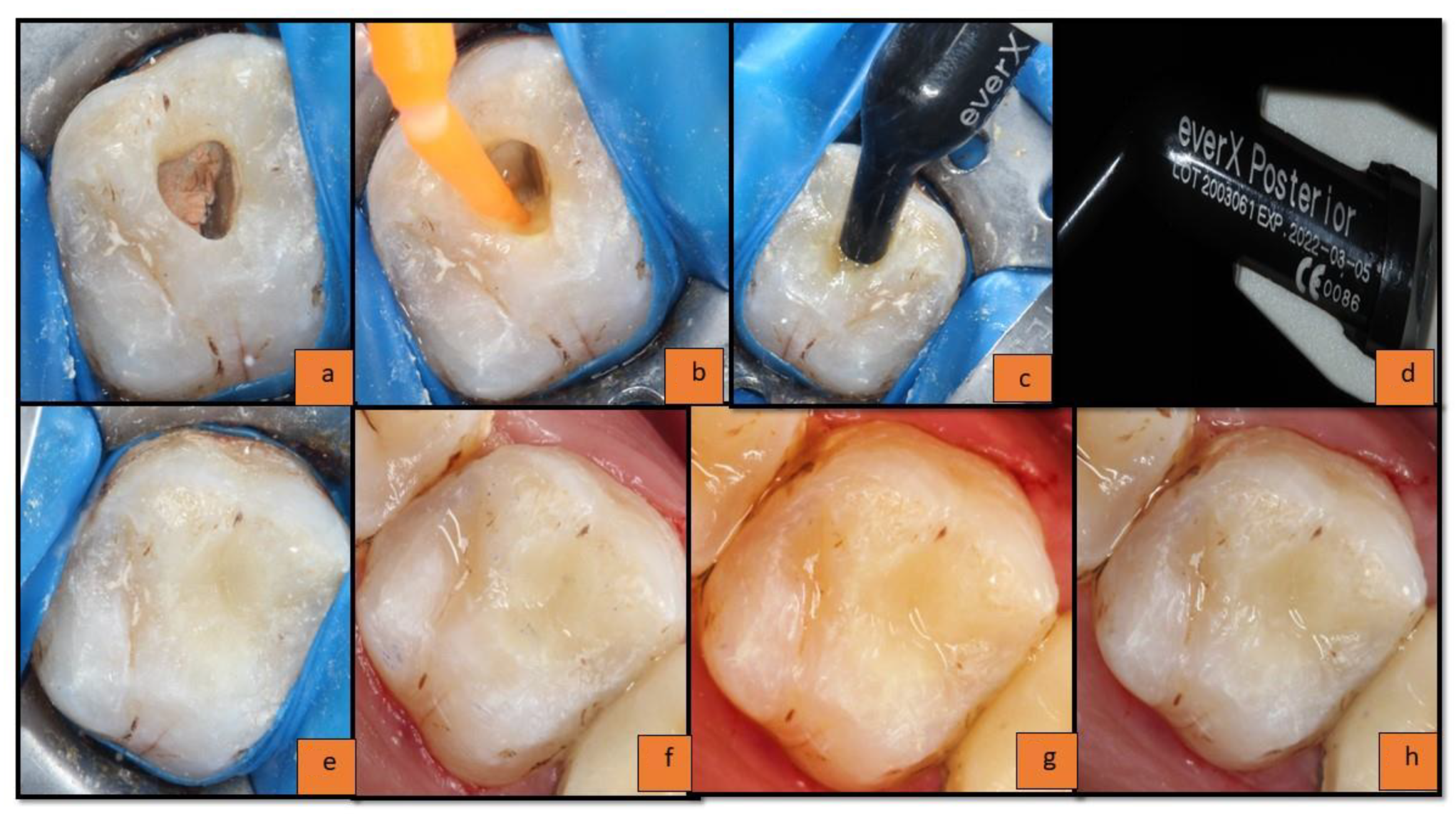 Materials 15 07858 g001