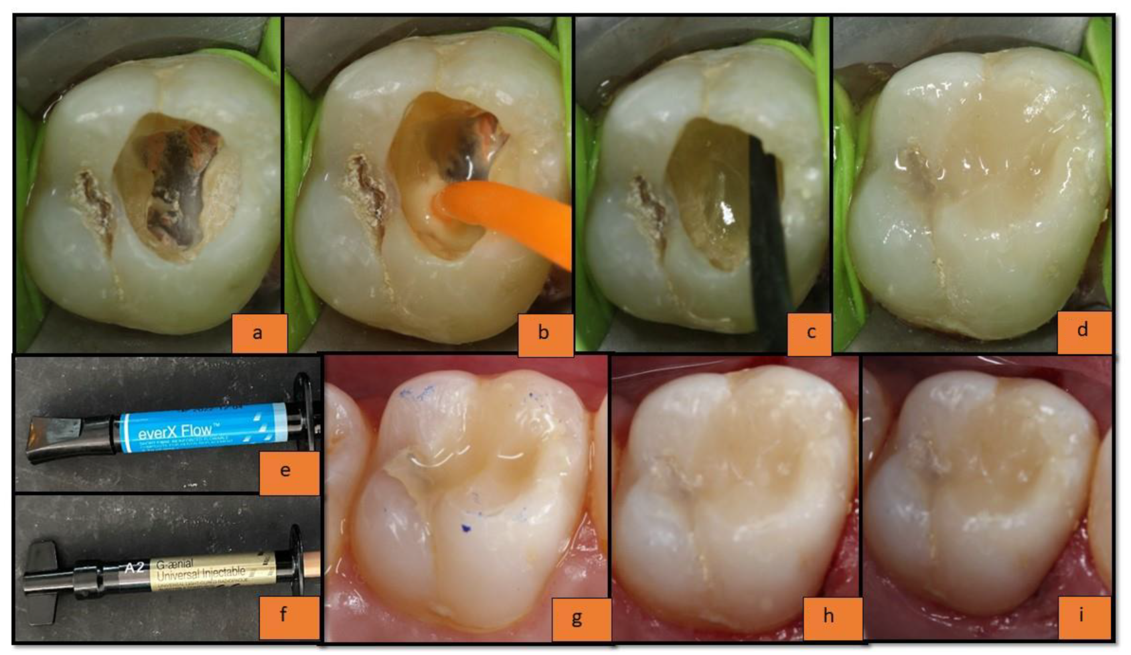 Materials 15 07858 g002