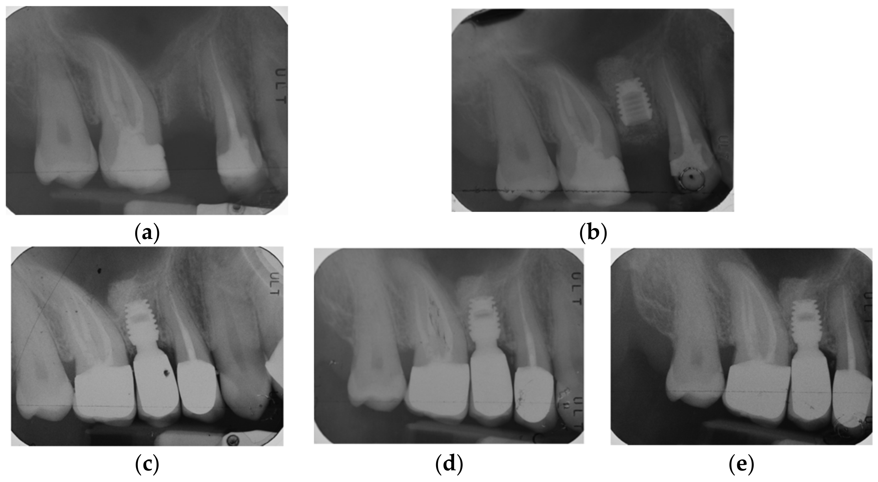 Materials 15 07995 g003 Materials 15 07995 g003
