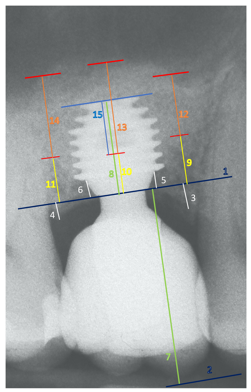 Materials 15 07995 g0a1 Materials 15 07995 g0a1