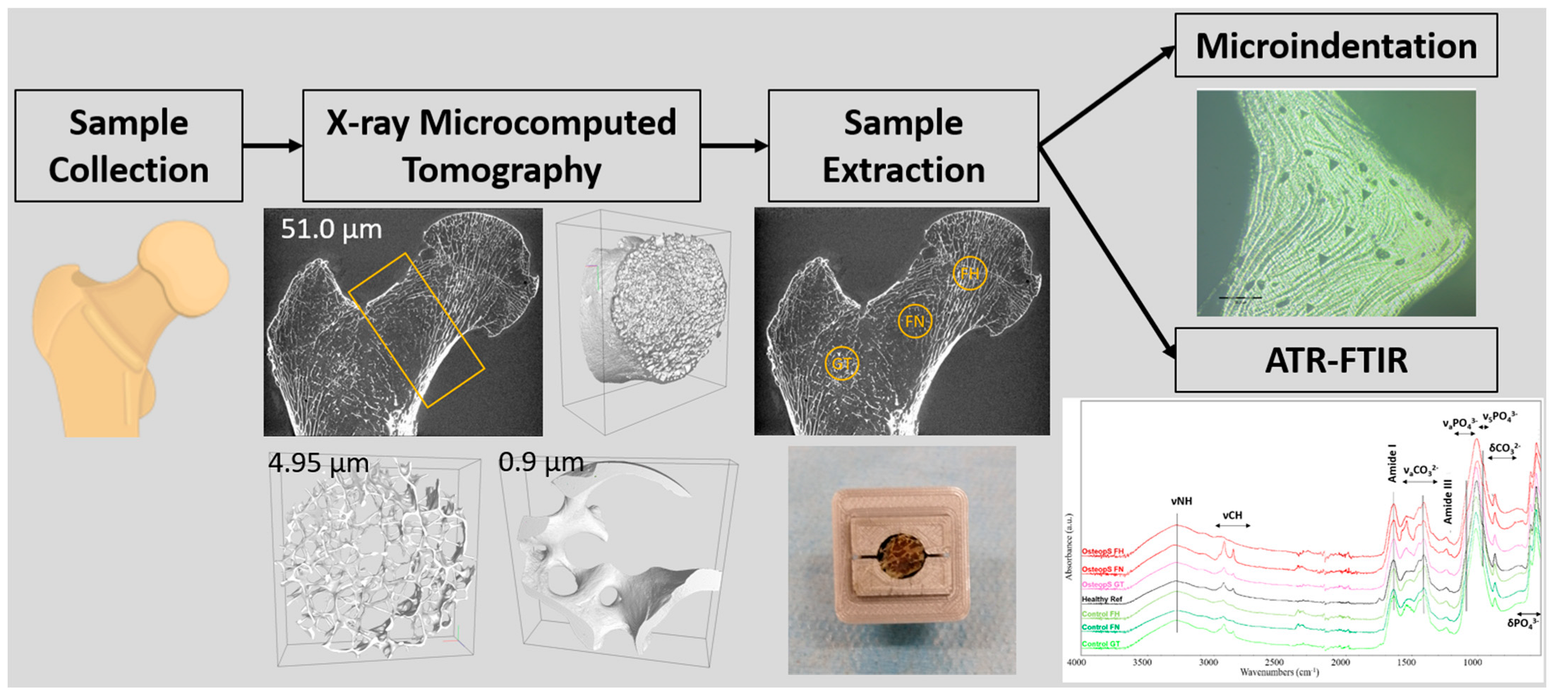 日本全国送料無料商品 特集 Multiscale Trabeculae Multimodal and Imaging Neck Femoral 医学一般