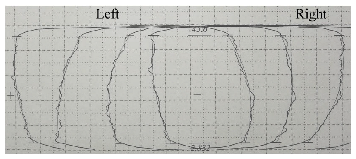 Materials 15 08081 i006