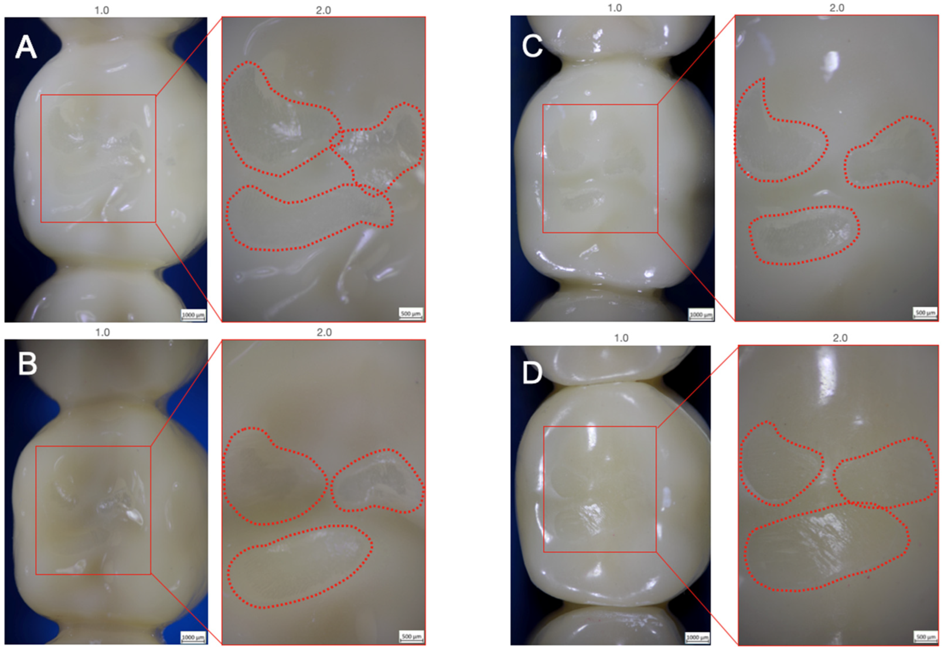 Materials 15 08465 g003
